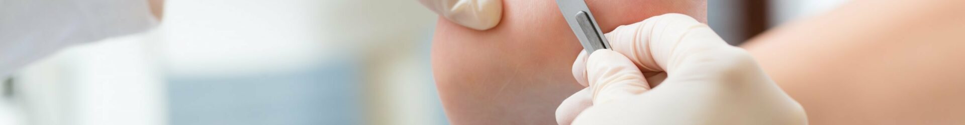 Cómo detectar a tiempo una fascitis plantar y evitar complicaciones