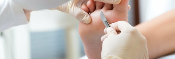 Cómo detectar a tiempo una fascitis plantar y evitar complicaciones